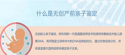 锡林郭勒盟怀孕怎么做血缘检测，锡林郭勒盟做孕期亲子鉴定需要的材料